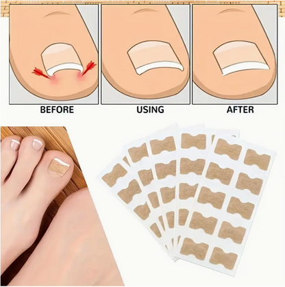 NAGELHERO – Nagelverzorging Stickers