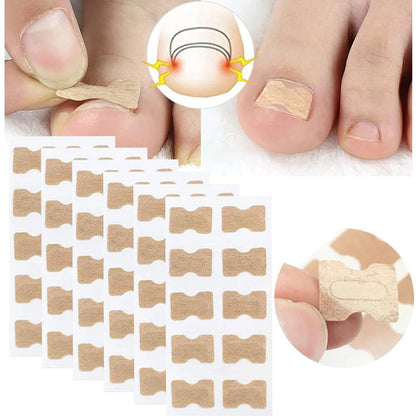 NAGELHERO – Nagelverzorging Stickers