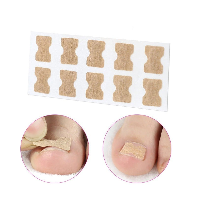 NAGELHERO – Nagelverzorging Stickers